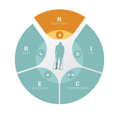 Changing RICE to NICER: Nutrition & Recovery