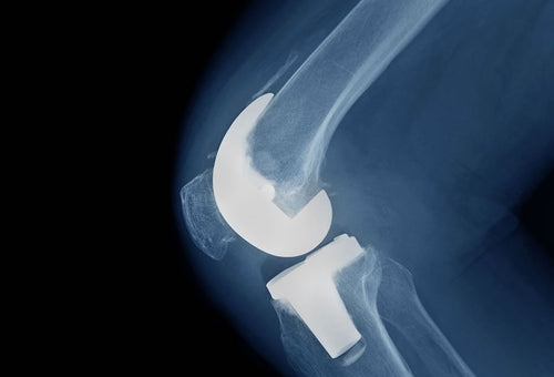 Paper in Journal of Applied Physiology Supporting MEND TKA Intervention
