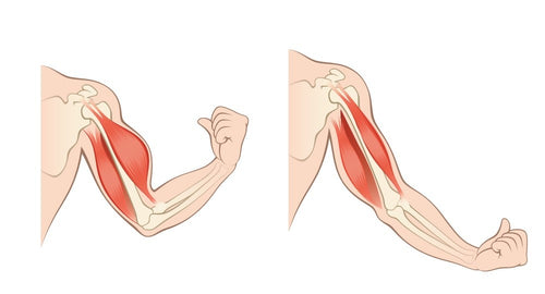 Muscle Atrophy and Weakness After Joint Replacement Surgery